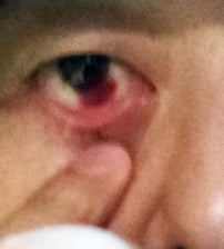 鉄　は　熱　い　う　ち　に　打　て　　　　(*ﾟ∀ﾟ)=3ﾑｯﾊｰ