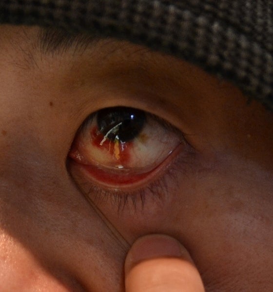 鉄　は　熱　い　う　ち　に　打　て　　　　(*ﾟ∀ﾟ)=3ﾑｯﾊｰ